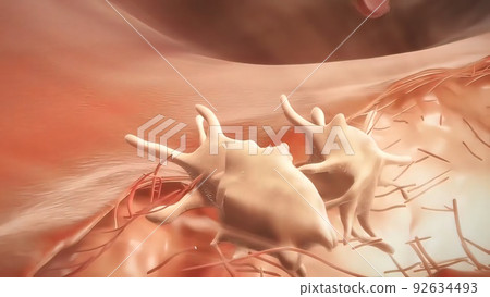 Hemophilia is a bleeding disorder that slows the blood clotting process. 92634493