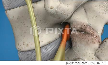 3D illustration of the spinal cord on blue background. Endoscopic lumbar discectomy 3D illustration of the spinal cord on blue background. Endoscopic lumbar discectomy 92646153