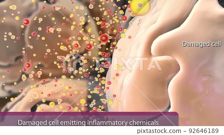 Inflammation is the standard, initial response of the body to injury Inflammation is the standard, initial response of the body to injury 92646189