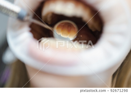 Close-up dental mirror in the mouth. .Macro photography of the process of examining teeth 92671298