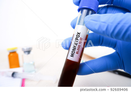 Monkeypox (MPXV) blood sample in test tube holding by doctor hand Monkeypox (MPXV) blood sample in test tube holding by doctor hand 92689406