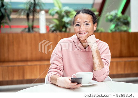 Black african american woman with vitiligo  92698143