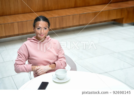 Black african american woman with vitiligo  92698145