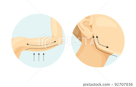 Plastic Surgery for Arms and Face as Restoration and Reconstruction of Human Body in Circle Vector Set 92707836
