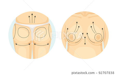 Plastic Surgery for Female Breast and Buttocks as Restoration and Reconstruction of Human Body Part in Circle Vector Set Plastic Surgery for Female Breast and Buttocks as Restoration and Reconstruction of Human Body Part in Circle Vector Set 92707838