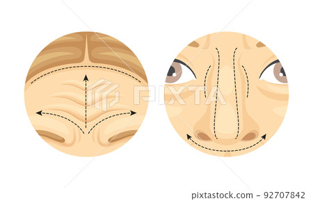 Plastic Surgery as Restoration and Reconstruction of Human Forehead and Nose in Circle Vector Set Plastic Surgery as Restoration and Reconstruction of Human Forehead and Nose in Circle Vector Set 92707842