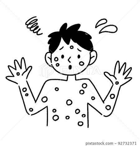 猴痘男性插圖黑白 猴痘男性插圖黑白 92732371