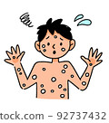 Monkeypox male illustration 92737432
