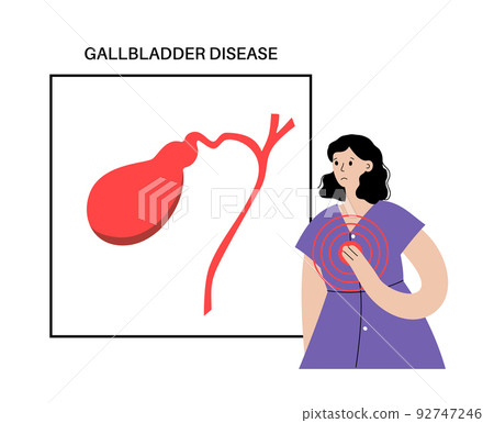 gallbladder disease poster 92747246