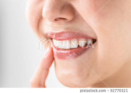 Female tooth dentistry 92770321