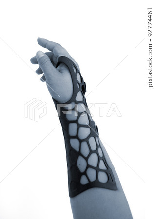 Orthopedic plastic prosthesis printed on powder 3D printer on hand. Isolated on white background. Gypsum close-up. Multi Jet Fusion MJF 3D printing technology. Modern progressive additive technology Orthopedic plastic prosthesis printed on powder 3D printer on hand. Isolated on white background. Gypsum close-up. Multi Jet Fusion MJF 3D printing technology. Modern progressive additive technology 92774461