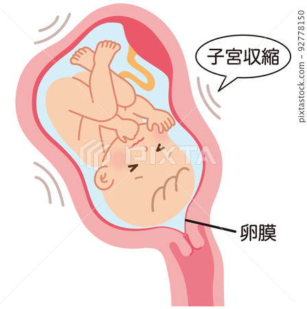 即將早產，子宮中的嬰兒，懷孕期間的母體機制 92778150