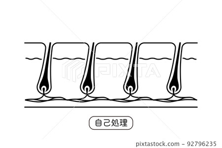 Image of hair removal, self-treatment after hair treatment 92796235