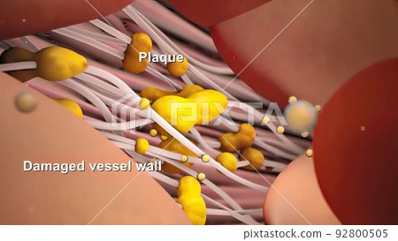 Travelling shot in the bloodstream Travelling shot in the bloodstream 92800505