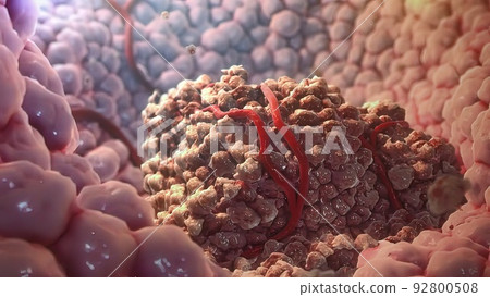Injection defense against tumors illustration 92800508