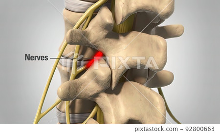 3D animated human skeleton spine degeneration in white 92800663