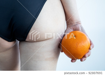Cellulite or orange skin effect. Woman holding orange by her legs Cellulite or orange skin effect. Woman holding orange by her legs 92807691