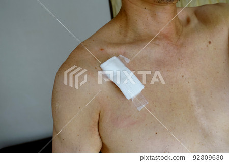 Chest wound, protected with gauze + tape Chest wound, protected with gauze + tape 92809680
