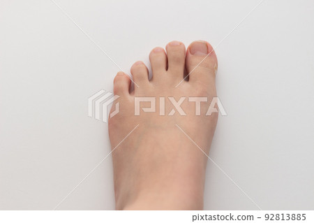 Athlete's foot of a woman 92813885