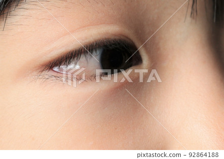 conjunctival edema conjunctival edema 92864188