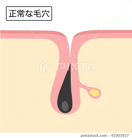 正常毛孔的圖片說明 92903937