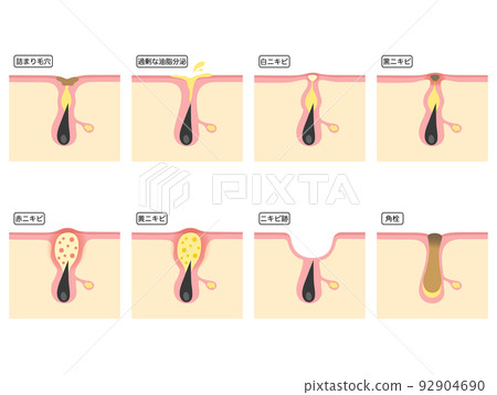 various skin problems 92904690