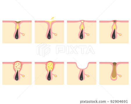 various skin problems various skin problems 92904691