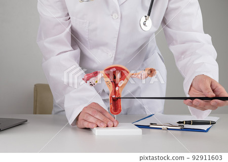 doctor gynecologist pointing model of female reproductive system on his desktop doctor gynecologist pointing model of female reproductive system on his desktop 92911603