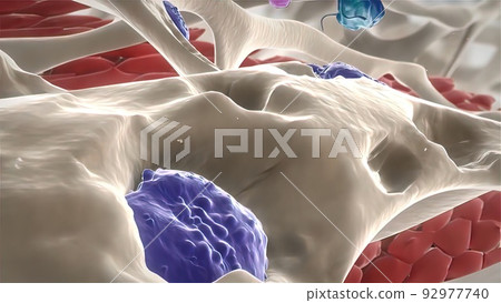 Disrupting bone structure, Rheumatoid Arthritis 92977740