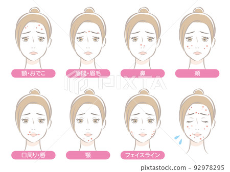 Places where acne on the face is likely to occur ・ Women 92978295
