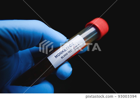 Monkeypox (MPXV) blood sample in test tube holding by doctor hand,Monkeypox concept 93003394