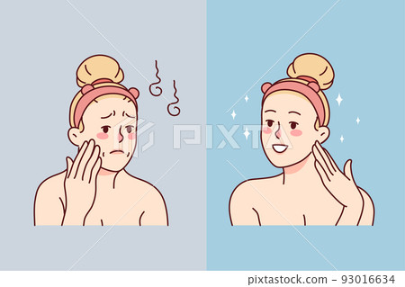 Woman before and after cosmetology procedures Woman before and after cosmetology procedures 93016634