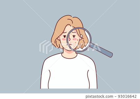 Unhappy woman with acne on face skin 93016642