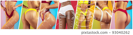 Collage with cropped images of slim female bodies with lifting up lines over colored background. Body shaping, liposuction, skin tightening, plastic surgery Collage with cropped images of slim female bodies with lifting up lines over colored background. Body shaping, liposuction, skin tightening, plastic surgery 93040262