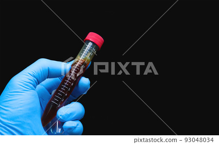 Blood sample in test tube holding by doctor hand Blood sample in test tube holding by doctor hand 93048034
