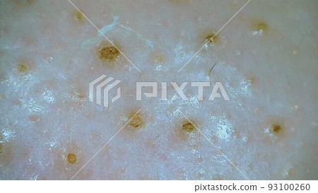 方塞鼻孔 93100260