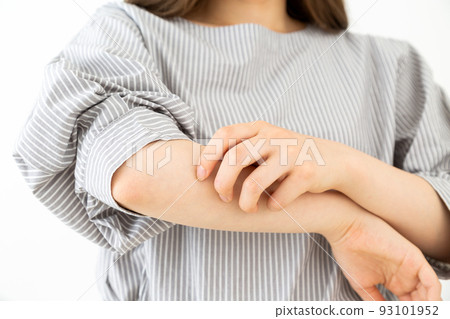 Atopic young woman scratching her arm Atopic young woman scratching her arm 93101952
