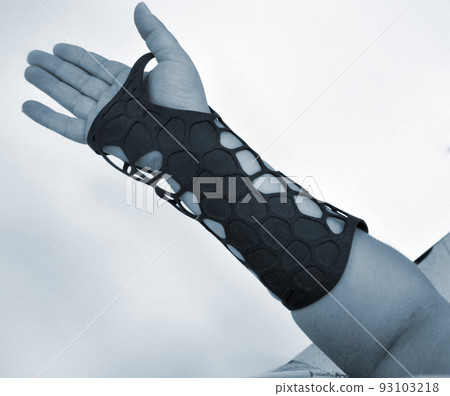 Orthopedic plastic prosthesis printed on powder 3D printer on hand isolated on white background. Gypsum close-up. Multi Jet Fusion MJF 3D printing technology. Modern progressive additive technology. 93103218