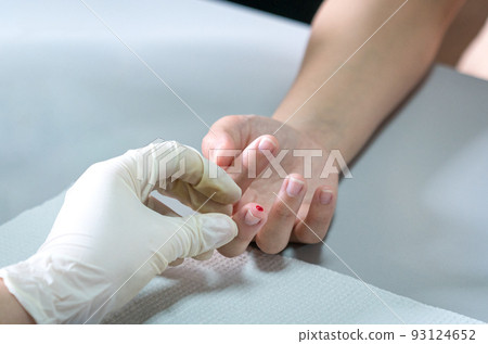 Taking blood sample from patient's finger. 93124652
