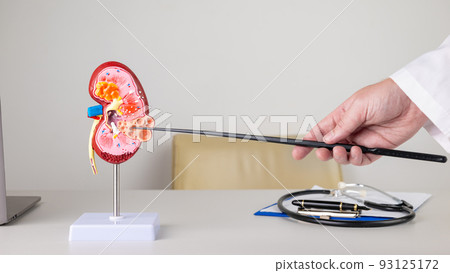 doctor nephrologist pointing at polycystic on a kidney mockup on his desktop 93125172