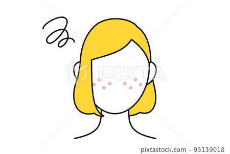 美容，女性皮膚護理形象，患有痤瘡皮膚的女性 93139018