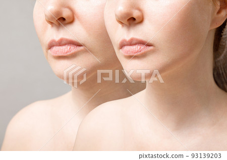A close portrait of an aged woman before and after the facelift procedure. The result of facial rejuvenation and wrinkle smoothing in a cosmetology clinic. A close portrait of an aged woman before and after the facelift procedure. The result of facial rejuvenation and wrinkle smoothing in a cosmetology clinic. 93139203