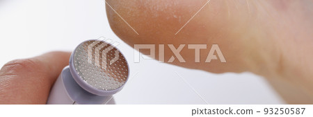 Callus peeling using professional pedicure drill machine. spa foot treatment Callus peeling using professional pedicure drill machine. spa foot treatment 93250587