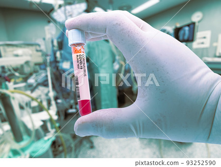 Coronavirus positive blood test. Coronavirus covid-19 outbreaking. Epidemic virus Respiratory Syndrome. Pharmaceutical & genetics Research Centre. Covid-19 Intensive care patients concept. Coronavirus positive blood test. Coronavirus covid-19 outbreaking. Epidemic virus Respiratory Syndrome. Pharmaceutical & genetics Research Centre. Covid-19 Intensive care patients concept. 93252590