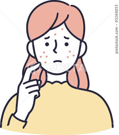一個患有痤瘡的女人簡單的插圖 93269855