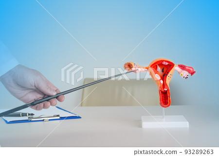 doctor gynecologist pointing model of female reproductive system on his desktop 93289263