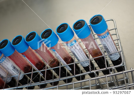 血液檢體 血液檢體 93297087