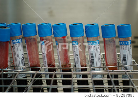 血液檢體 93297095