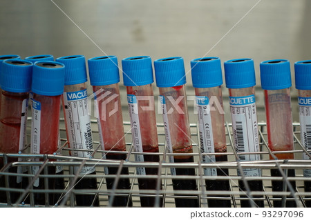 血液檢體 血液檢體 93297096