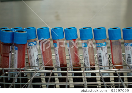 血液檢體 93297099